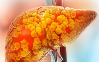¿Qué comer si tiene hígado graso? Alimentos recomendados y los que debería evitar